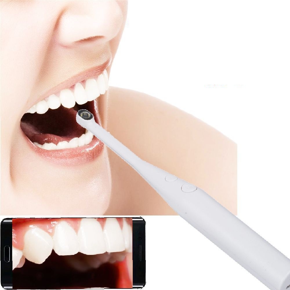 Visual Oral Endoscope - 1600x1200, IP67 Waterproof, 85° Angle
